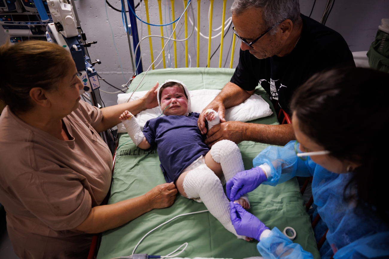 Child in hospital after burns during terrorist attack in Israel